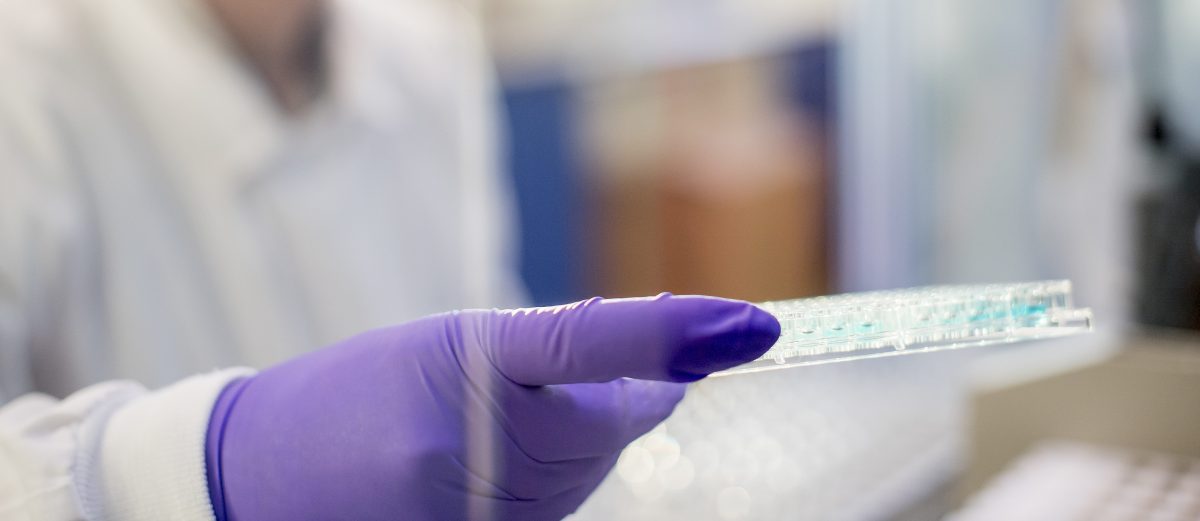 Biochemical Assays - Drug Discovery - Sygnature Discovery