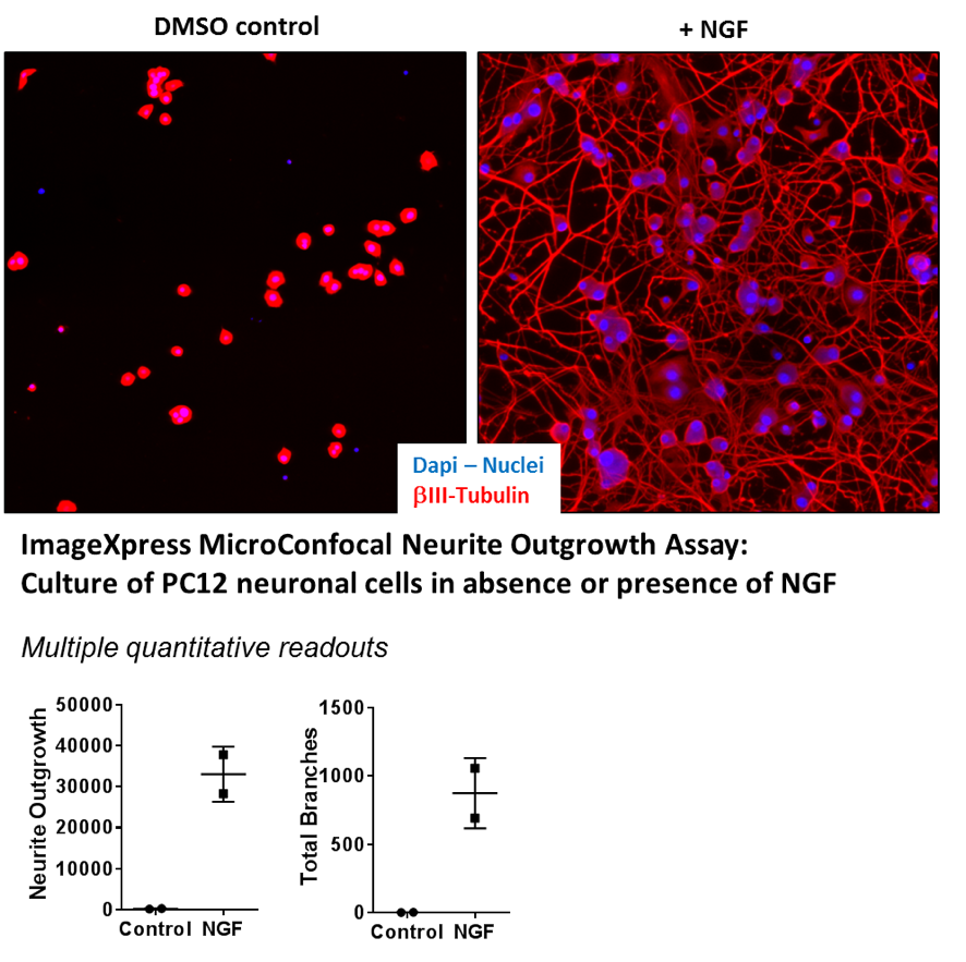 MicroConfocal Neurite Outgrowth Assay - PC12 Neuronal cells in absense or presense of NGF