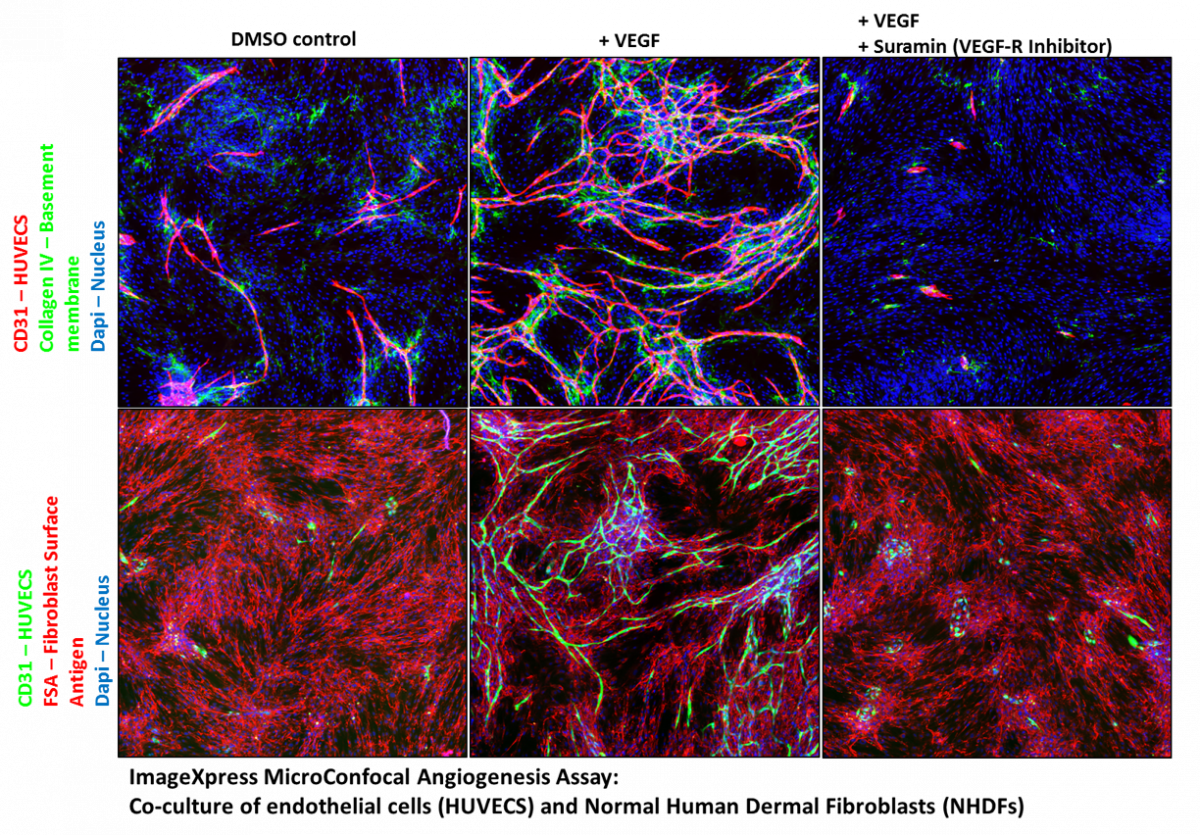 Co-Culture of Endothelial cells and Normal Human Dermal Fibroblasts