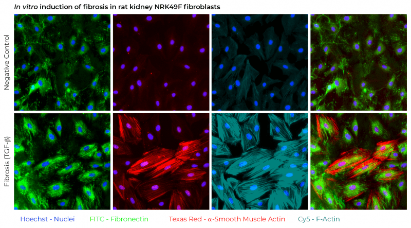 Fibrosis Assays