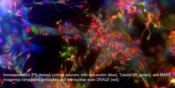 Scientific image of brain cells from oncology drug discovery project