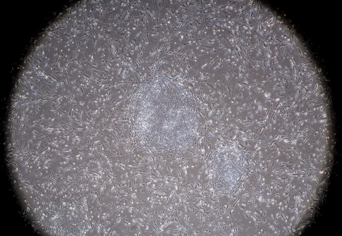 A small and a large colony of human induced Pluripotent Stem Cells in culture on top of mouse feeder cells.