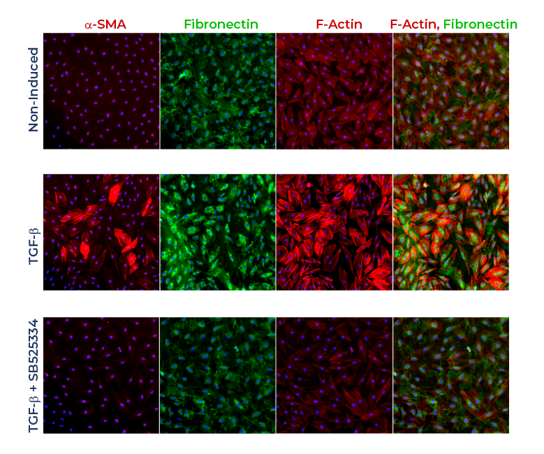 Confocal microscopy and immunofluorescent staining help assess these different cellular biomarkers.|
