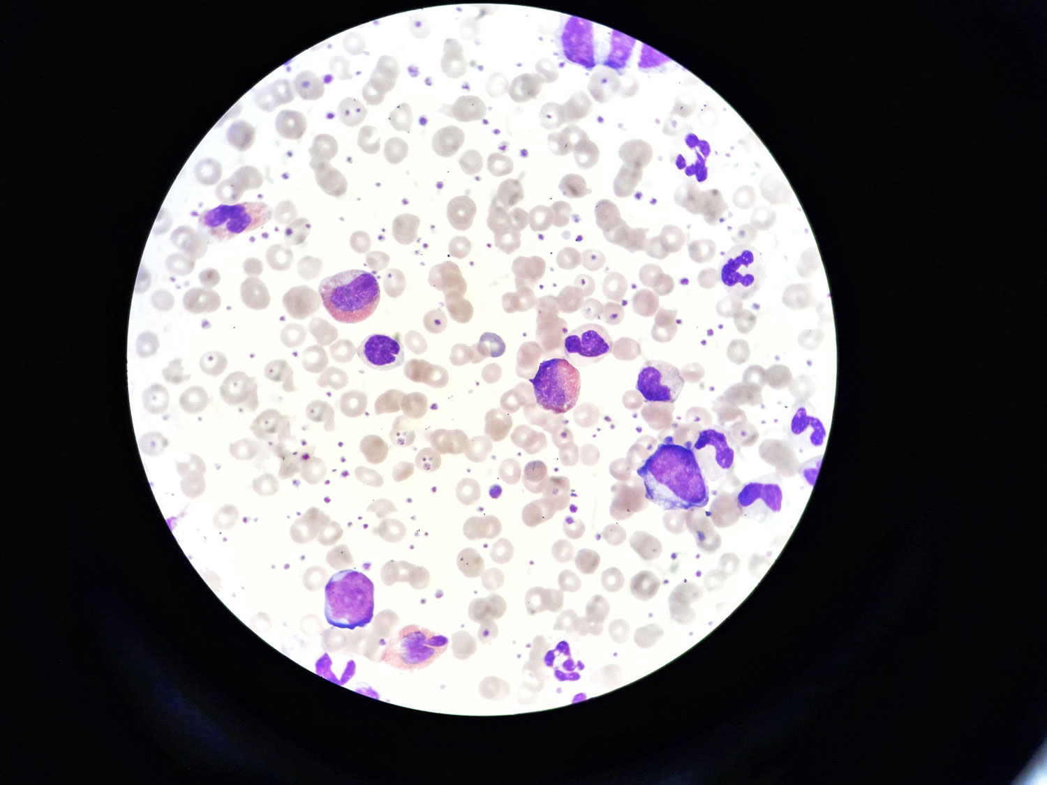Microscopic view of stained blood cells used in advanced blood-based assays, flow cytometry, and multi-parameter analysis for drug discovery.