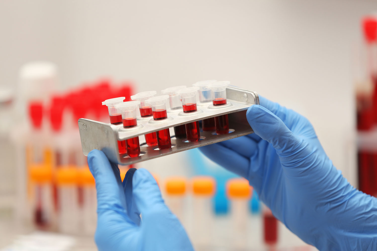 Close up gloved hands holding a laboratory rack with blood sample tubes, representing translation assays for inflammation and immunology research.