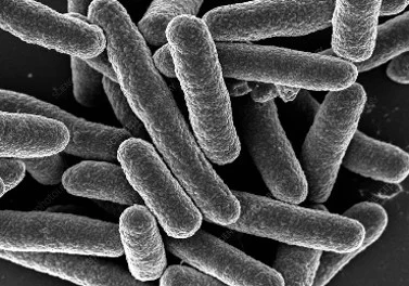 Optimizing Recombinant Cereblon-Midi Expression in E. coli Through Smart Strain Choice