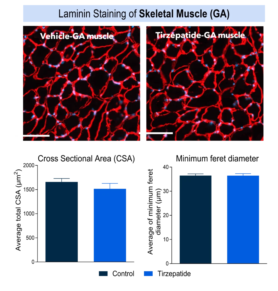 Skeletal muscle histology and fibre size measurements show no significant differences between tirzepatide-treated and control groups.